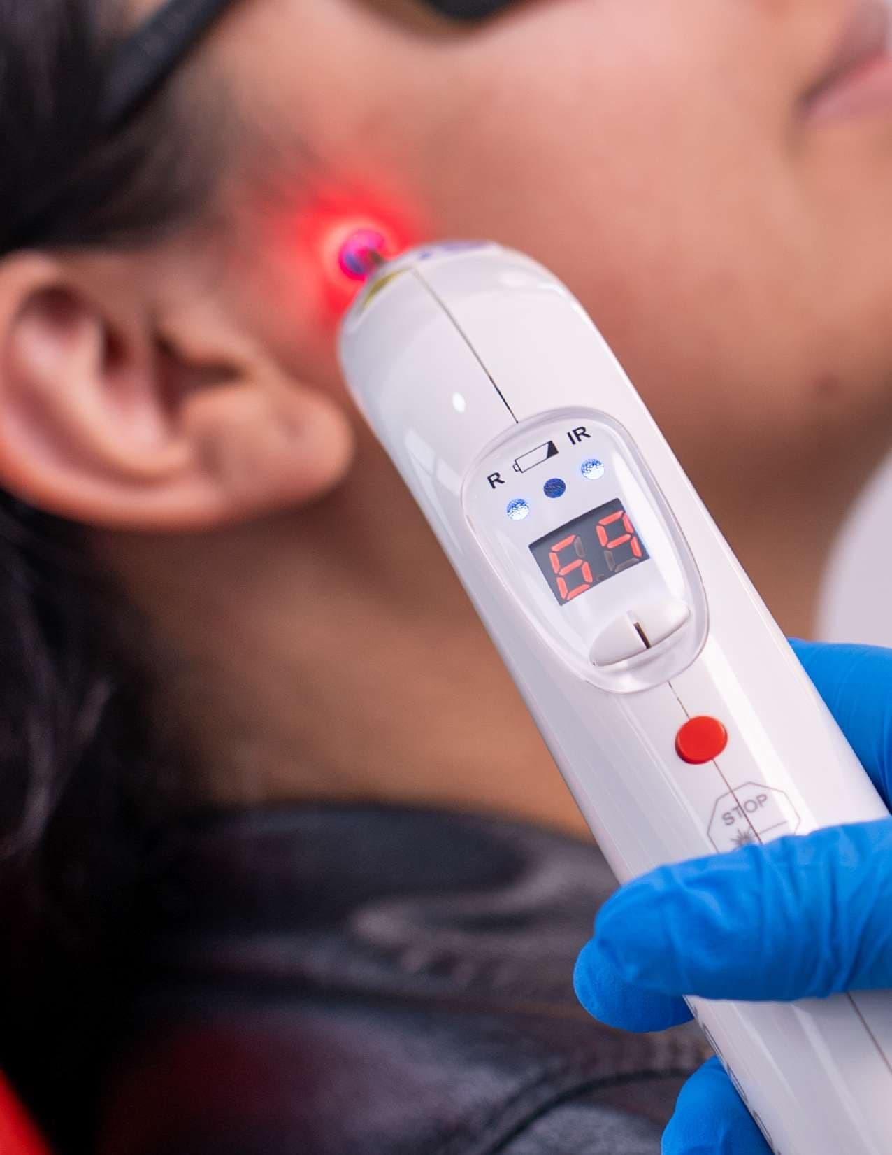 Aplicación de laserterapia con luz roja en el oído de un paciente
